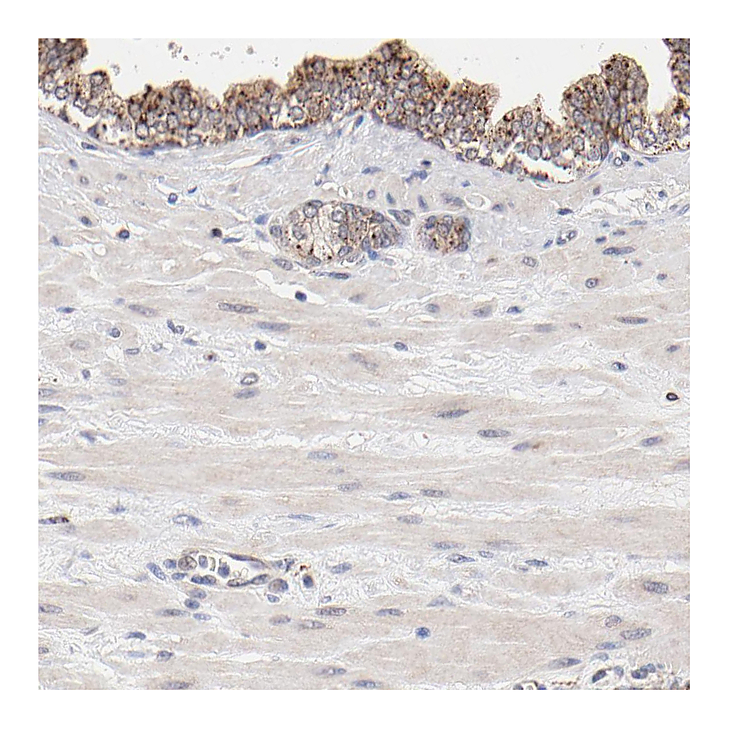 Atlas Antibodies Anti-PDE4B Antibody