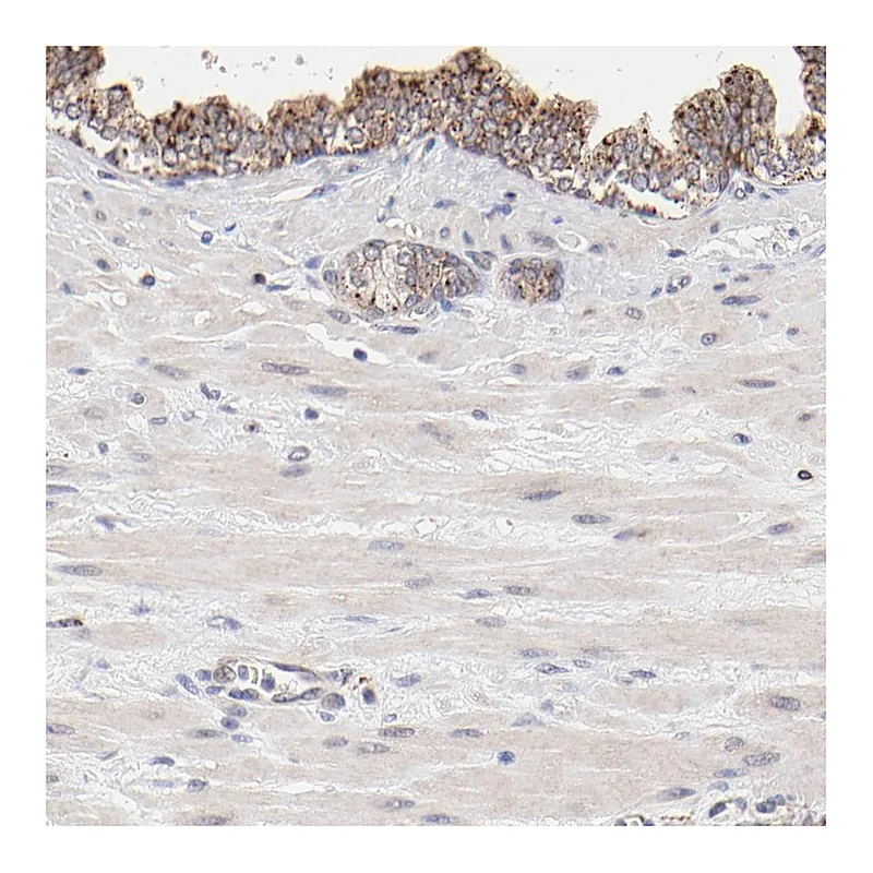 Atlas Antibodies Anti-PDE4B Antibody