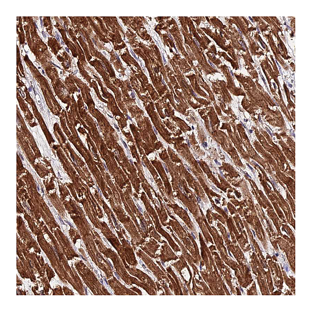 Atlas Antibodies Anti-PDE4D Antibody