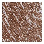 Atlas Antibodies Anti-PDE4D Antibody