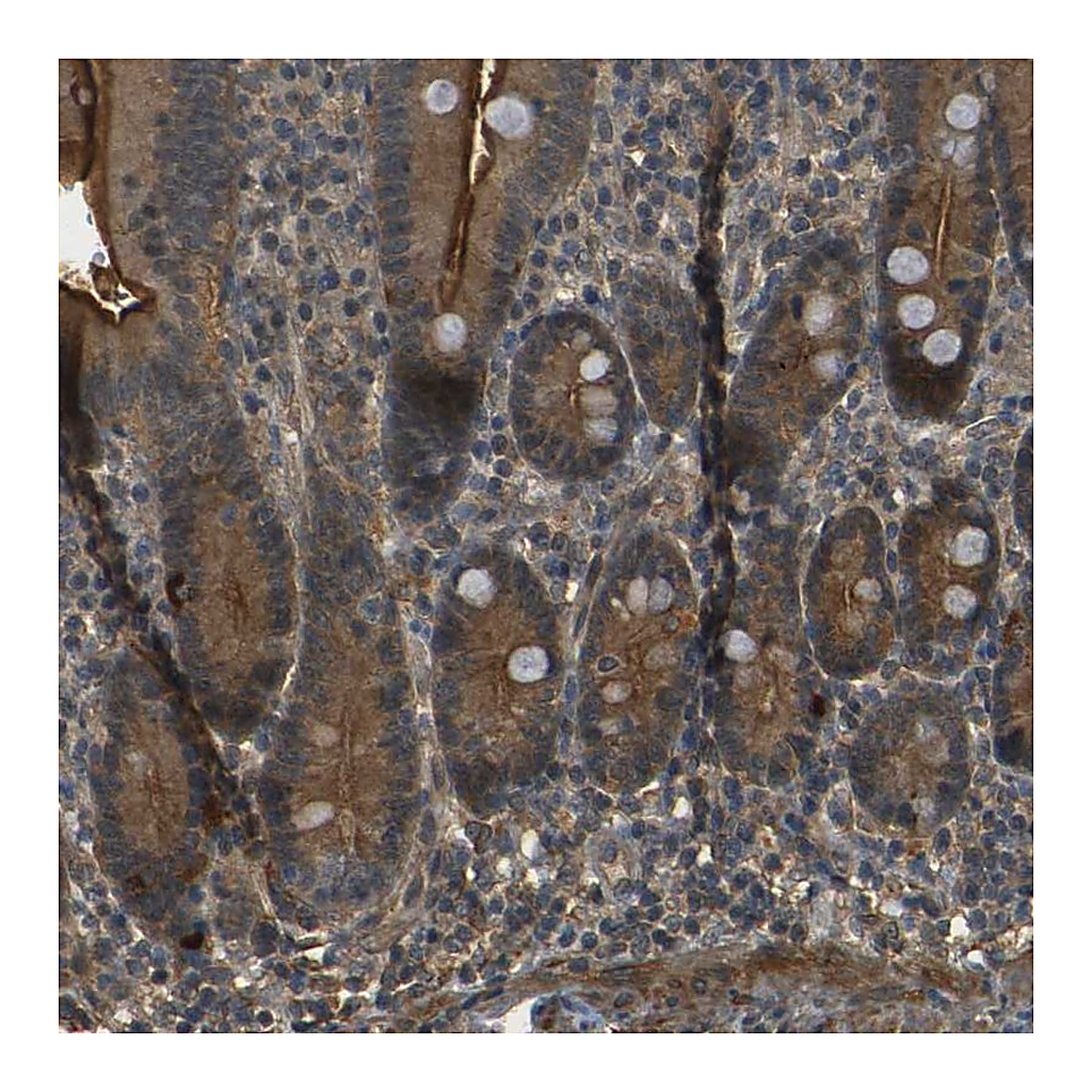 Atlas Antibodies Anti-PDE5A Antibody