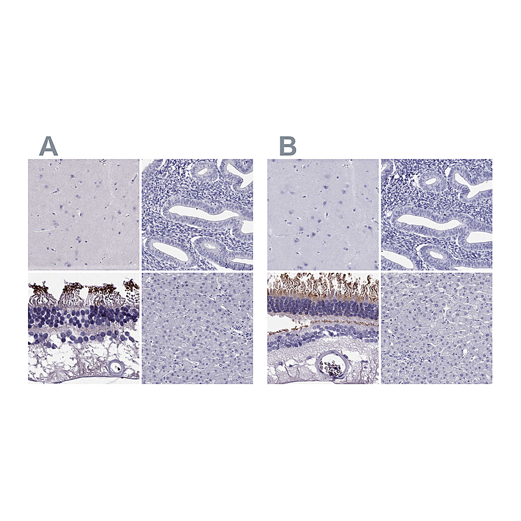 Atlas Antibodies Anti-PDE6A Antibody