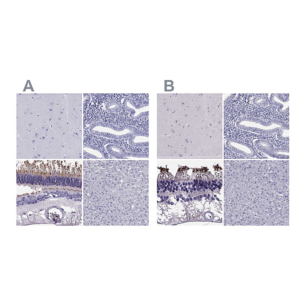 Atlas Antibodies Anti-PDE6A Antibody