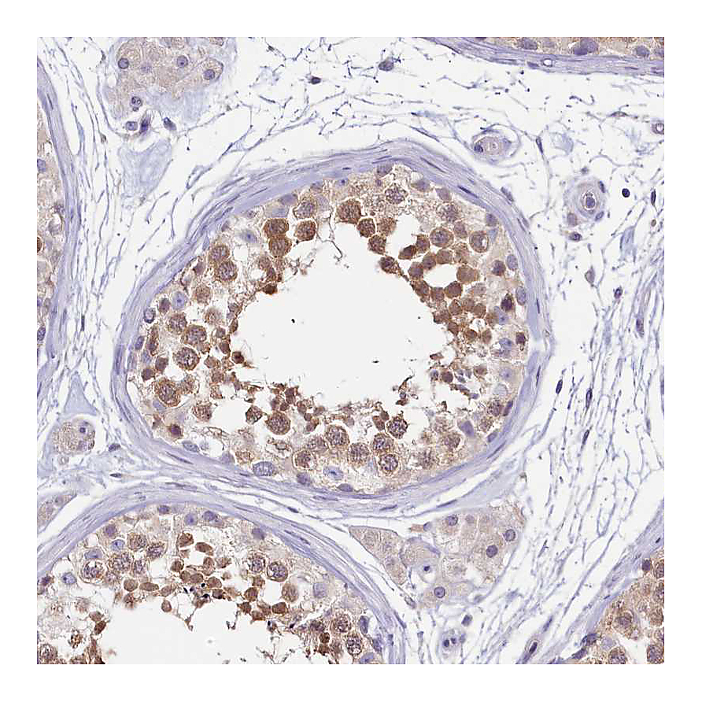 Atlas Antibodies Anti-PDE6D Antibody