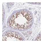 Atlas Antibodies Anti-PDE6D Antibody