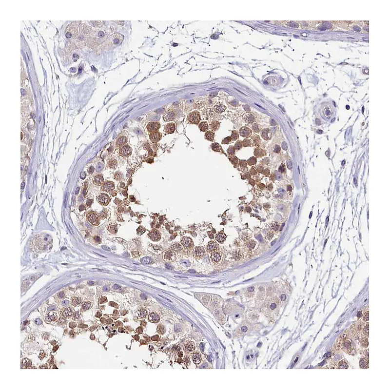 Atlas Antibodies Anti-PDE6D Antibody