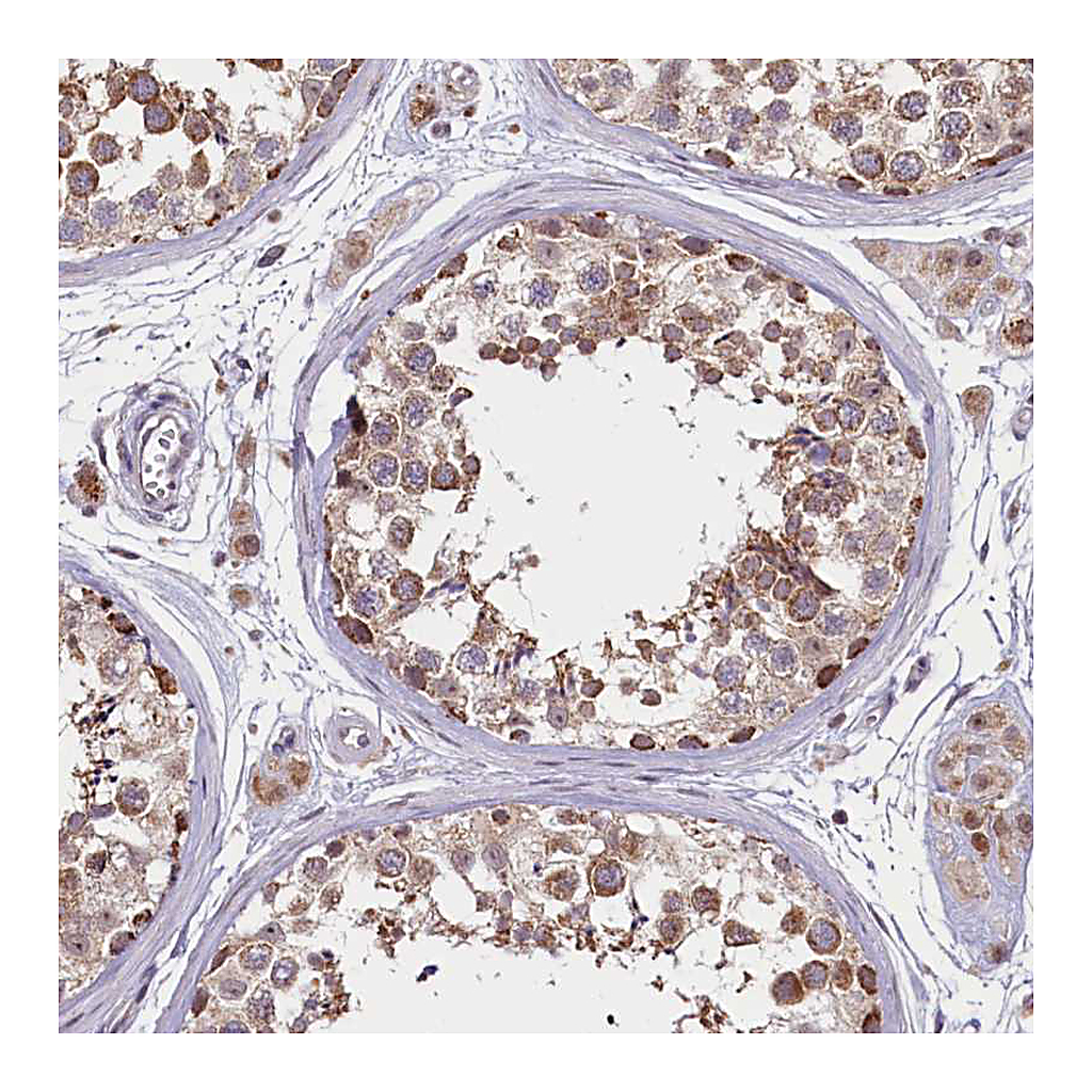 Atlas Antibodies Anti-PDE6D Antibody