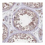 Atlas Antibodies Anti-PDE6D Antibody