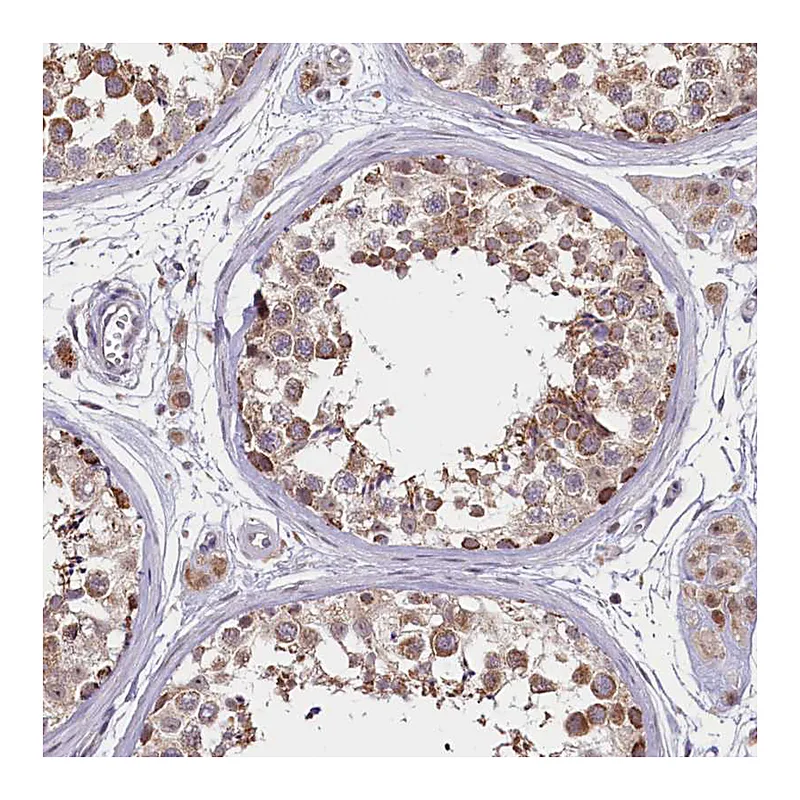 Atlas Antibodies Anti-PDE6D Antibody