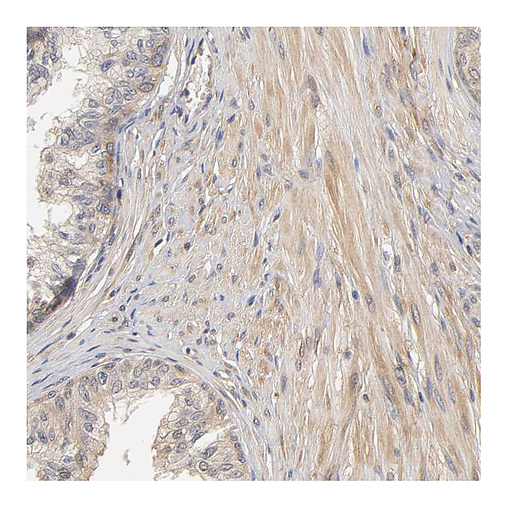 Atlas Antibodies Anti-PDE5A Antibody