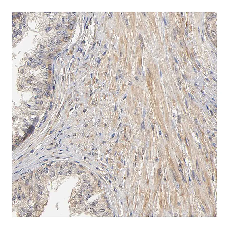 Atlas Antibodies Anti-PDE5A Antibody