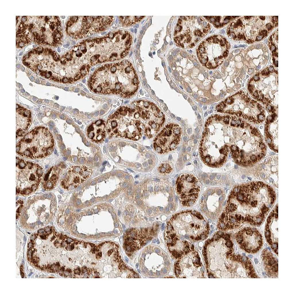 Atlas Antibodies Anti-PDE7B Antibody