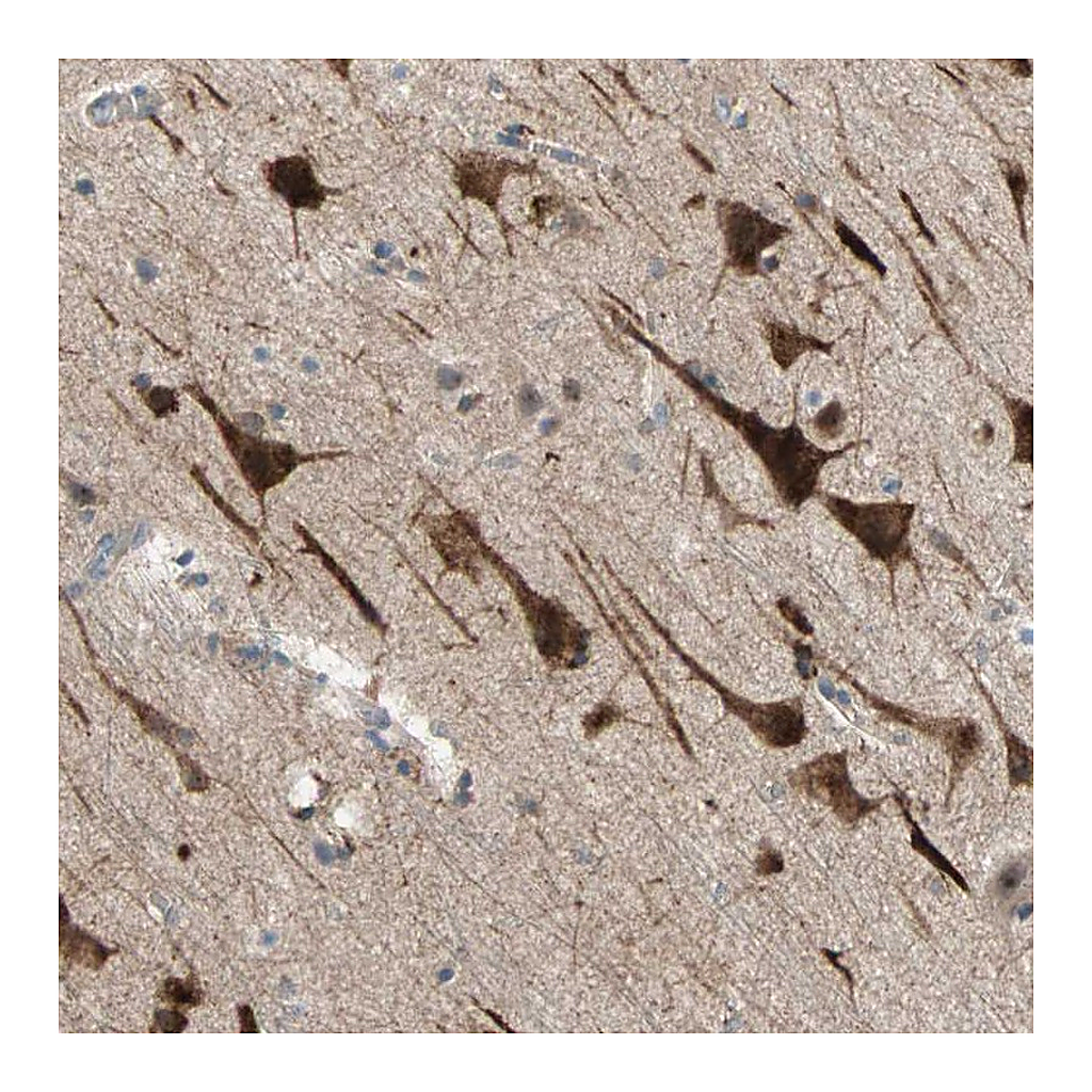 Atlas Antibodies Anti-PDE8A Antibody