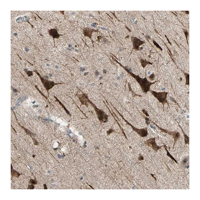 Atlas Antibodies Anti-PDE8A Antibody
