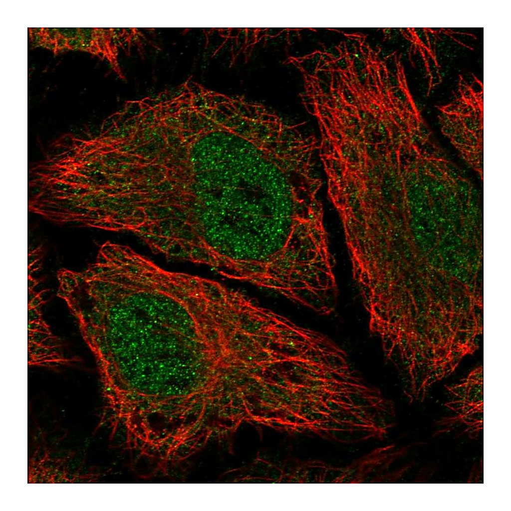 Atlas Antibodies Anti-PDE8B Antibody