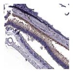 Atlas Antibodies Anti-PDE6H Antibody