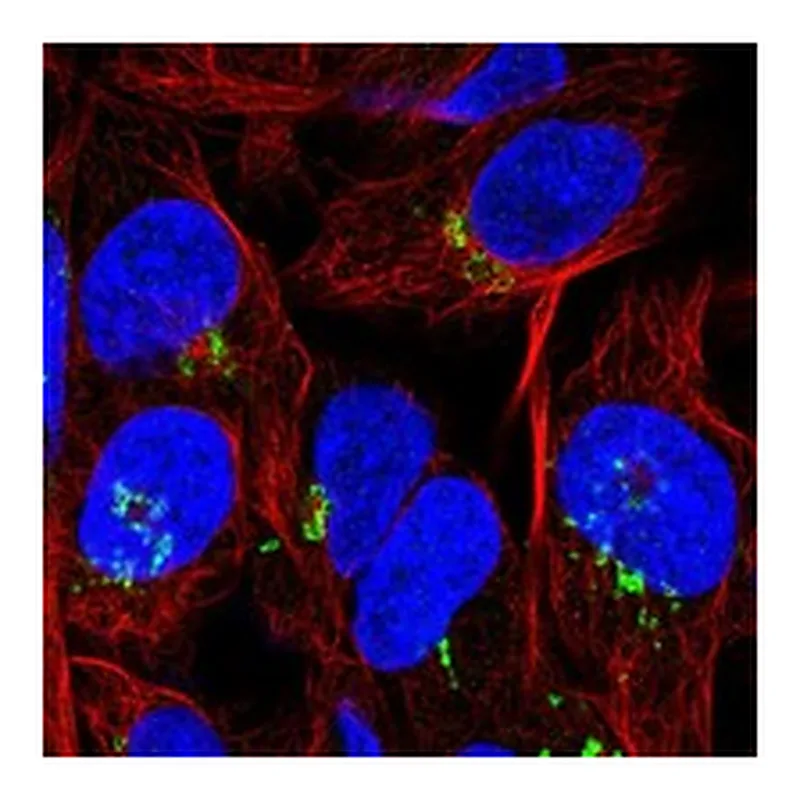 Atlas Antibodies Anti-PDGFA Antibody