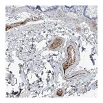 Atlas Antibodies Anti-PDGFC Antibody