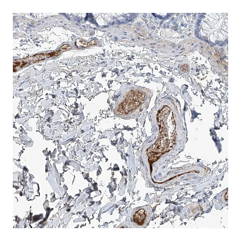 Atlas Antibodies Anti-PDGFC Antibody