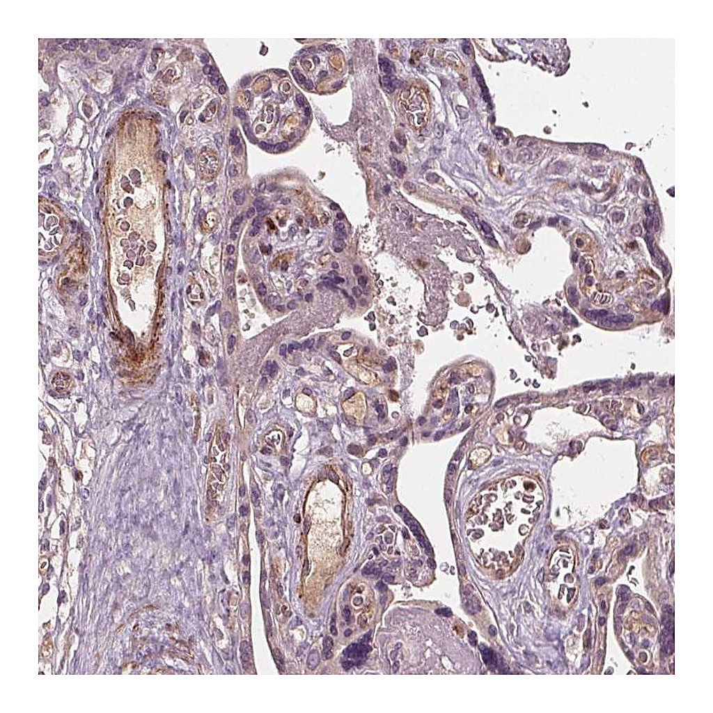 Atlas Antibodies Anti-PDGFD Antibody