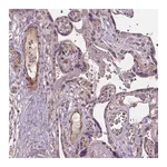 Atlas Antibodies Anti-PDGFD Antibody