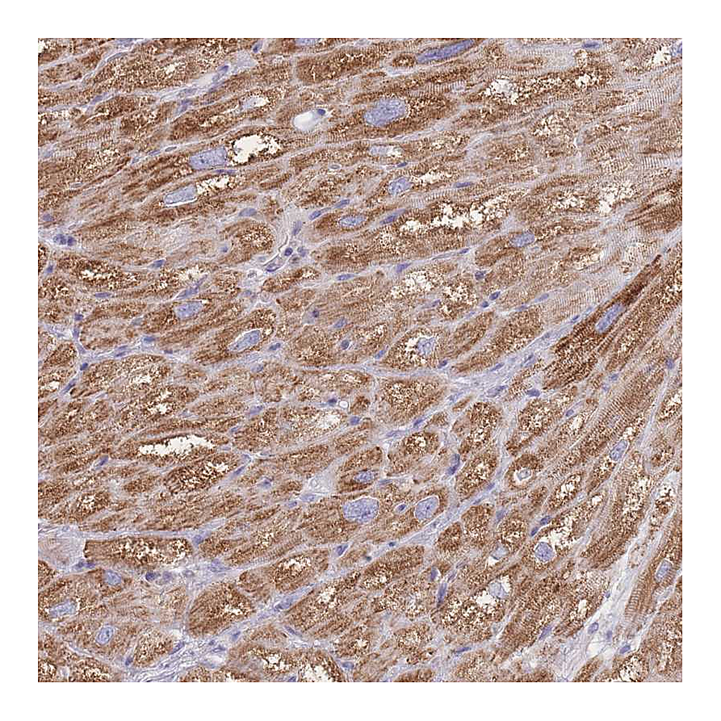 Atlas Antibodies Anti-PDHA1 Antibody