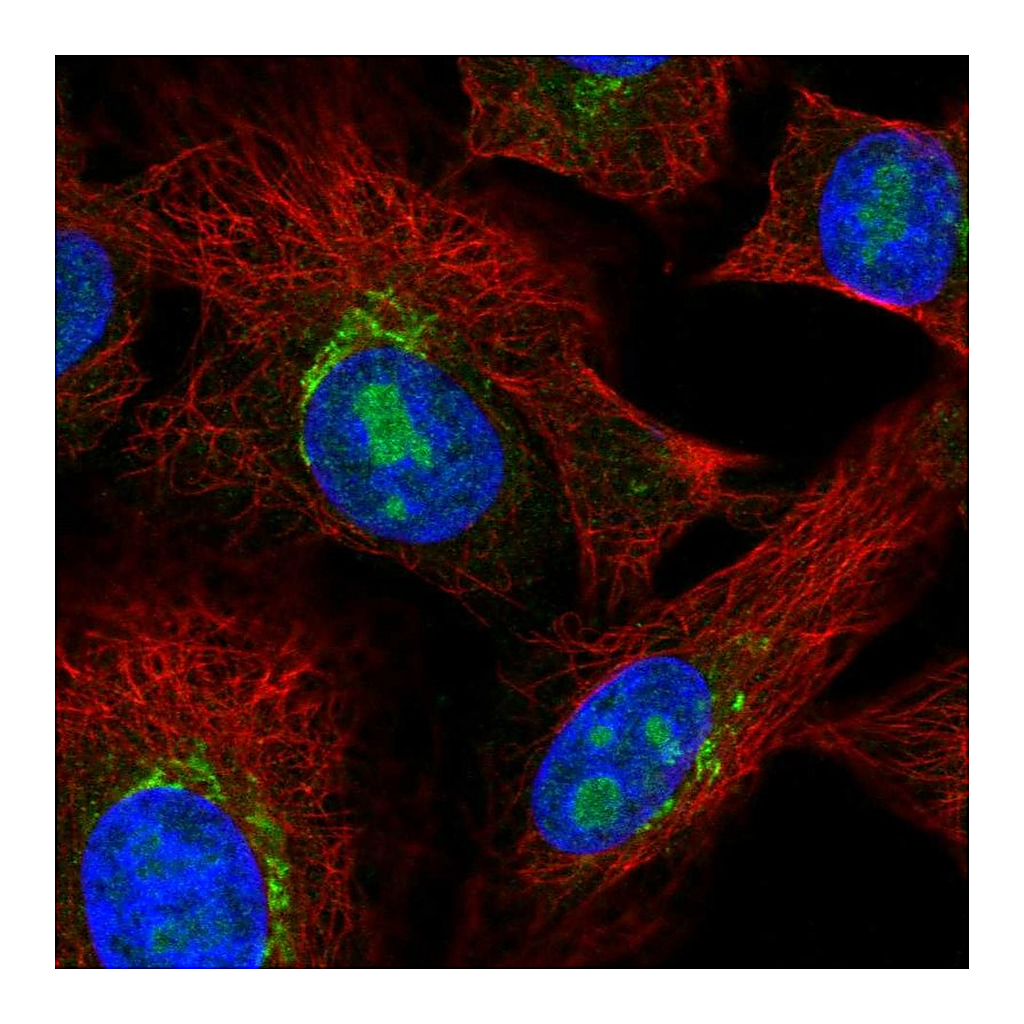Atlas Antibodies Anti-PDGFRL Antibody