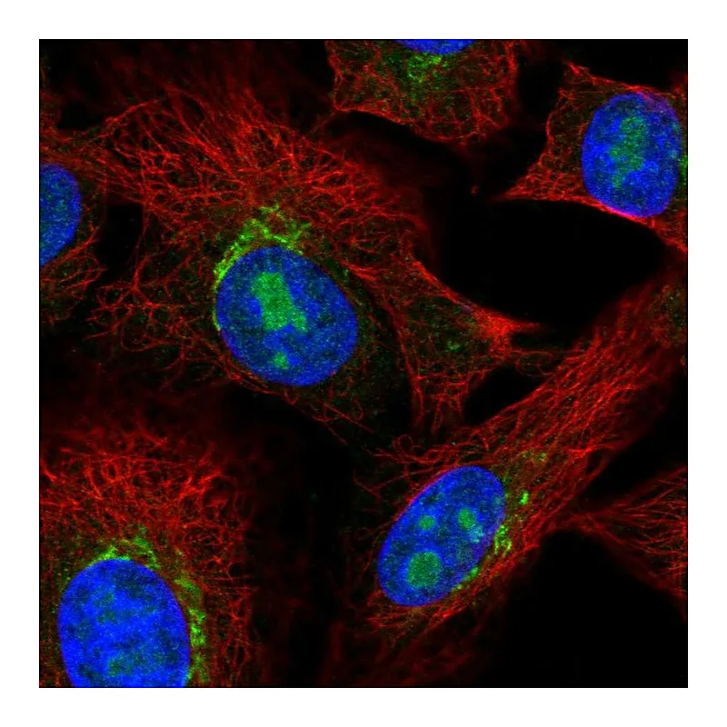 Atlas Antibodies Anti-PDGFRL Antibody