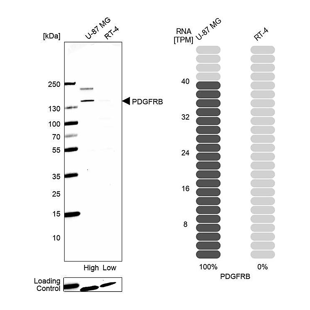 Atlas Antibodies Anti-PDGFRB Antibody