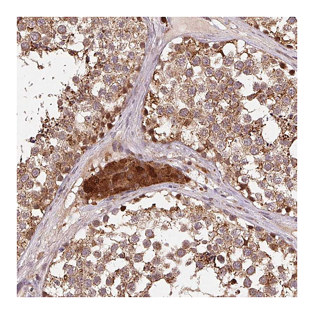 Atlas Antibodies Anti-PDHA1 Antibody