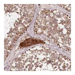 Atlas Antibodies Anti-PDHA1 Antibody