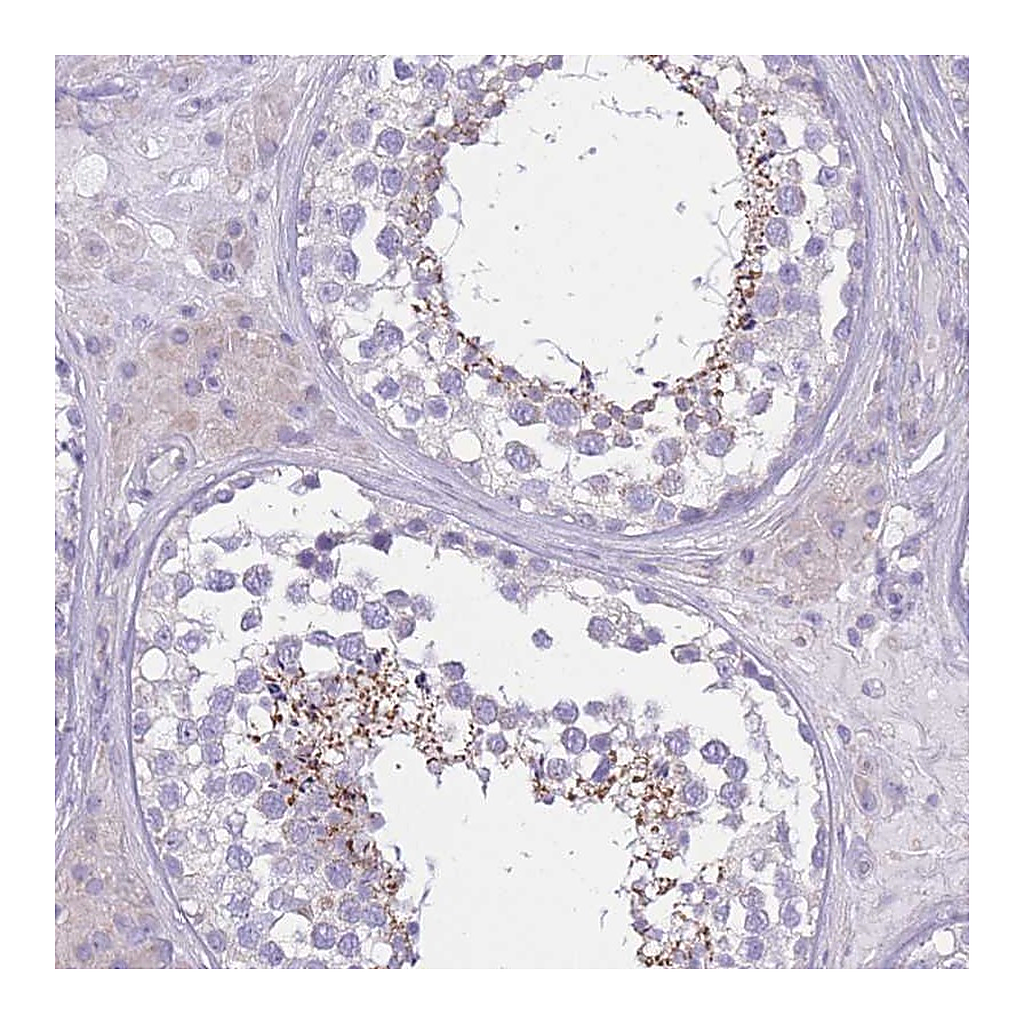 Atlas Antibodies Anti-PDHA2 Antibody