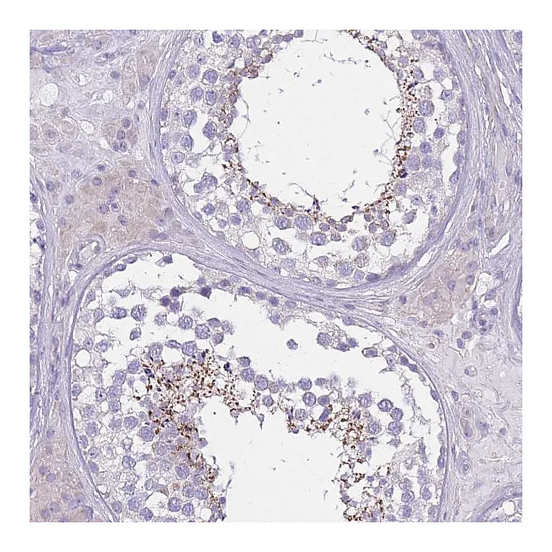 Atlas Antibodies Anti-PDHA2 Antibody