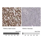 Atlas Antibodies Anti-PDHB Antibody