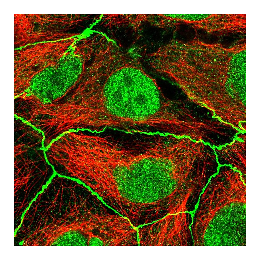 Atlas Antibodies Anti-PDGFRA Antibody