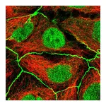 Atlas Antibodies Anti-PDGFRA Antibody