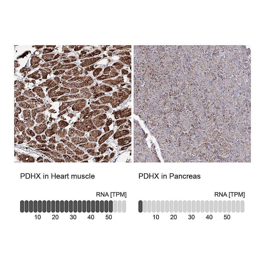 Atlas Antibodies Anti-PDHX Antibody