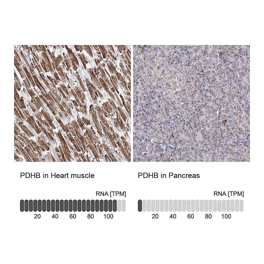 Atlas Antibodies Anti-PDHB Antibody