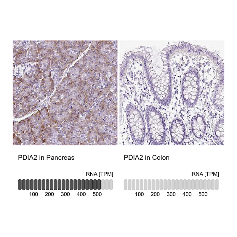 Atlas Antibodies Anti-PDIA2 Antibody