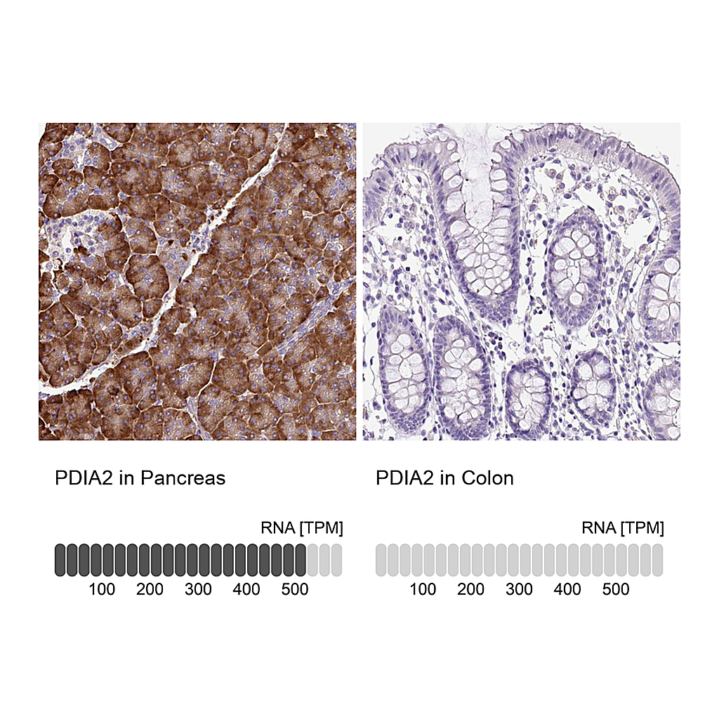 Atlas Antibodies Anti-PDIA2 Antibody