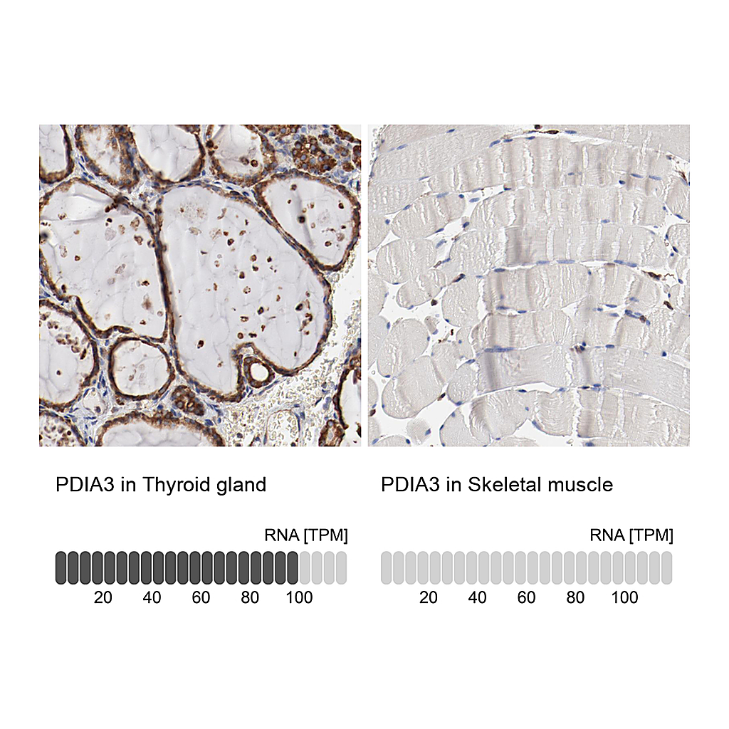 Atlas Antibodies Anti-PDIA3 Antibody