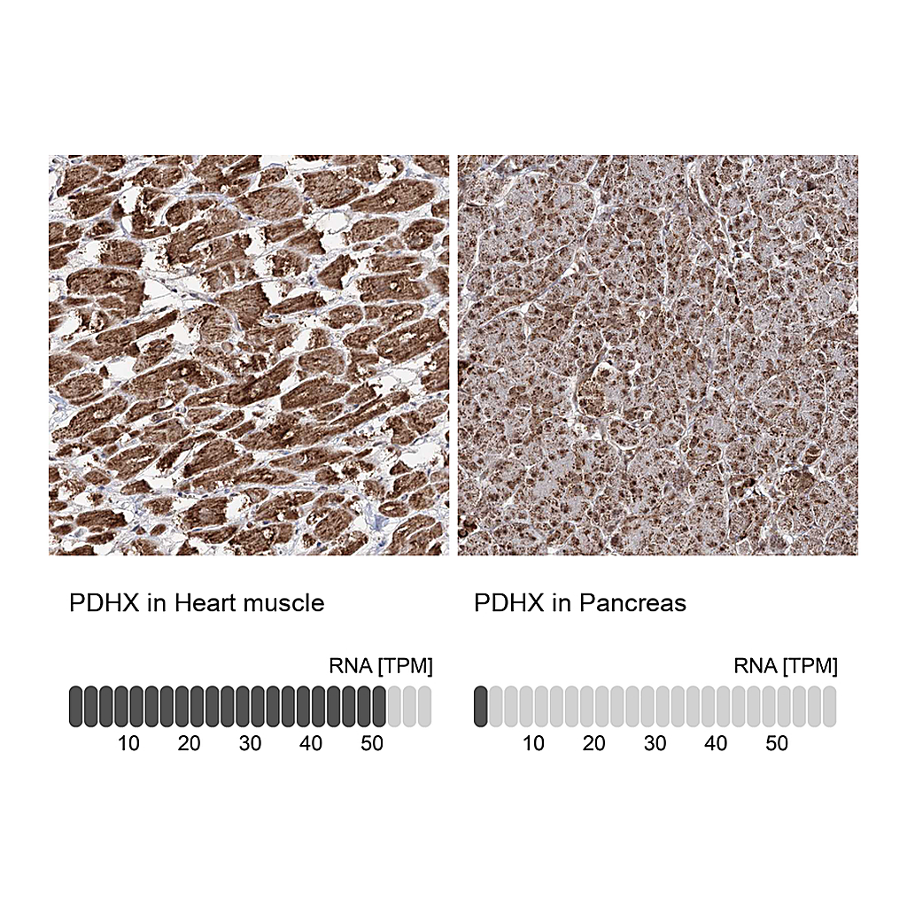 Atlas Antibodies Anti-PDHX Antibody