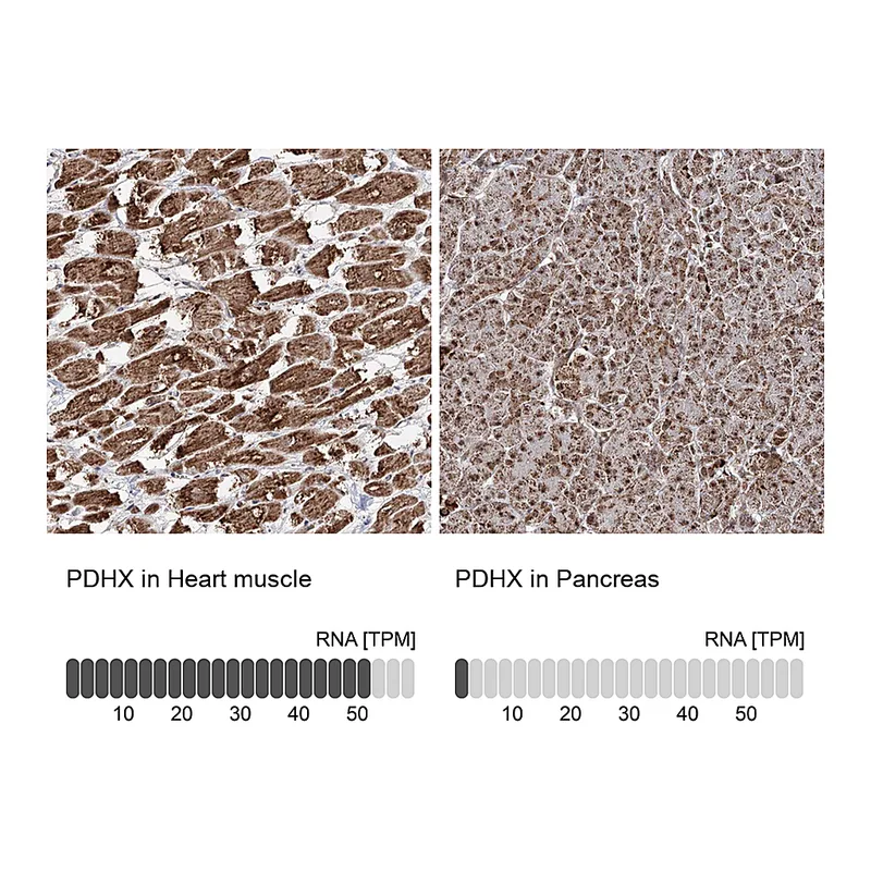Atlas Antibodies Anti-PDHX Antibody