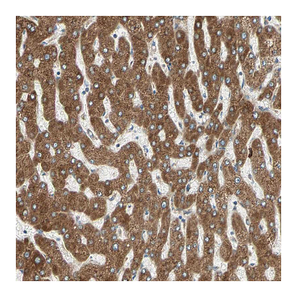 Atlas Antibodies Anti-PDIA4 Antibody