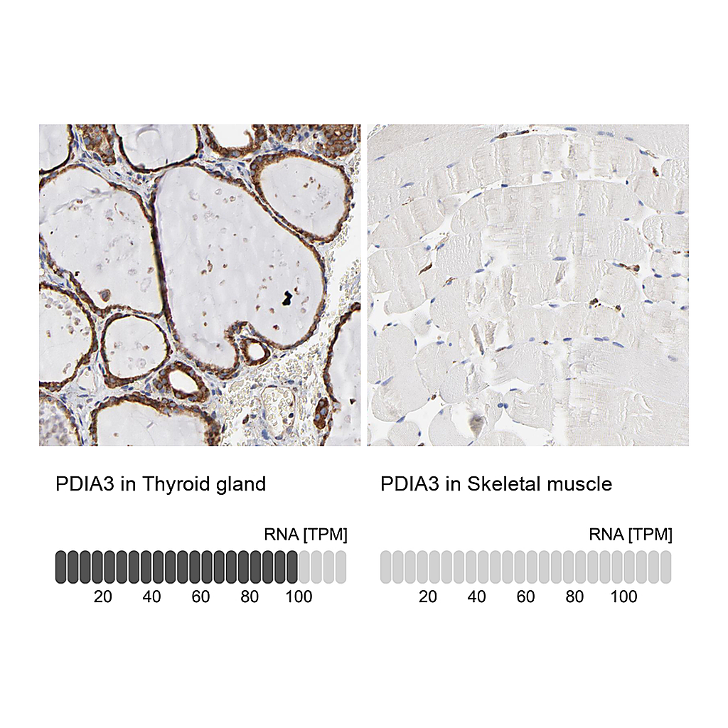 Atlas Antibodies Anti-PDIA3 Antibody