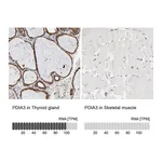 Atlas Antibodies Anti-PDIA3 Antibody