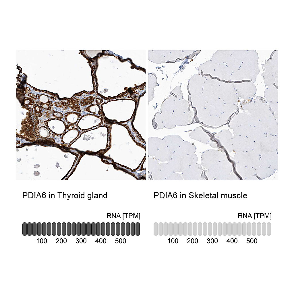 Atlas Antibodies Anti-PDIA6 Antibody