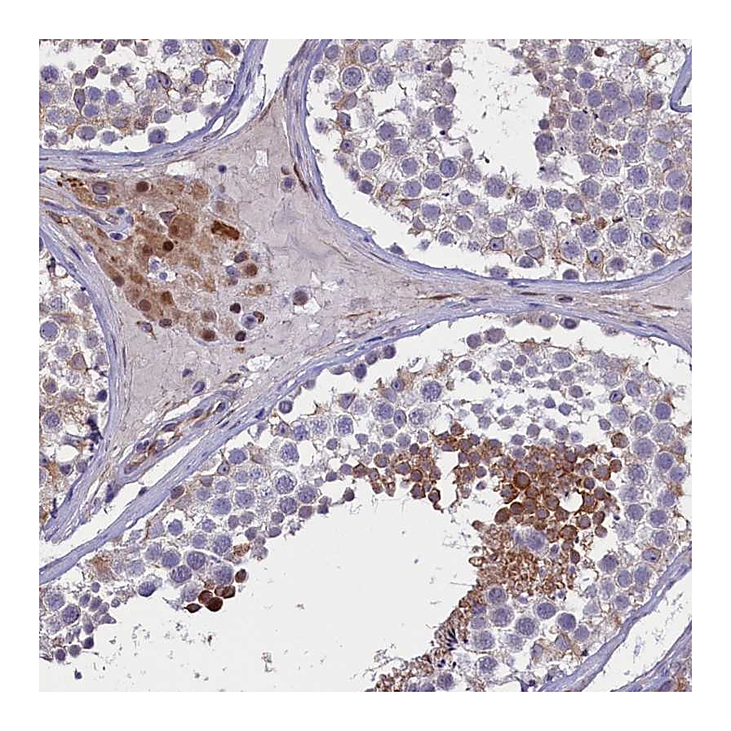Atlas Antibodies Anti-PDILT Antibody