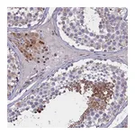 Atlas Antibodies Anti-PDILT Antibody