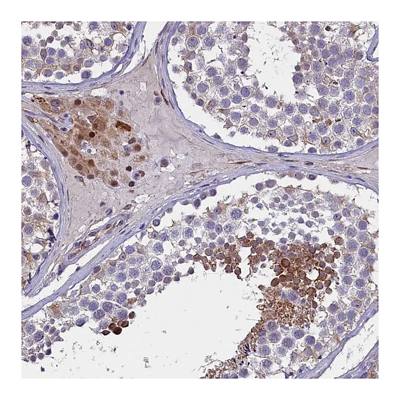 Atlas Antibodies Anti-PDILT Antibody